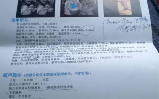 喉彩超数据分析，喉彩超数据分析准确吗